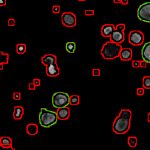 Fibrosi cistica: nuovi metodi di elaborazione delle immagini accelerano gli studi sui farmaci 2