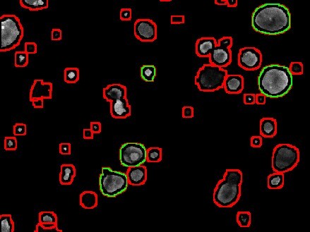 Fibrosi cistica: nuovi metodi di elaborazione delle immagini accelerano gli studi sui farmaci 2