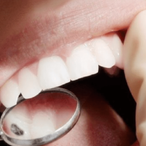 Amalgama dentale, adottato il Piano nazionale per l’eliminazione