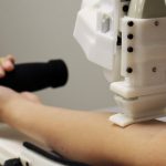 Cina, messo a punto un robot che facilita la venipuntura