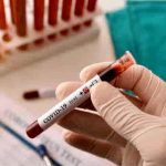 Coronavirus, anticorpi restano 6 mesi nel sangue dei guariti