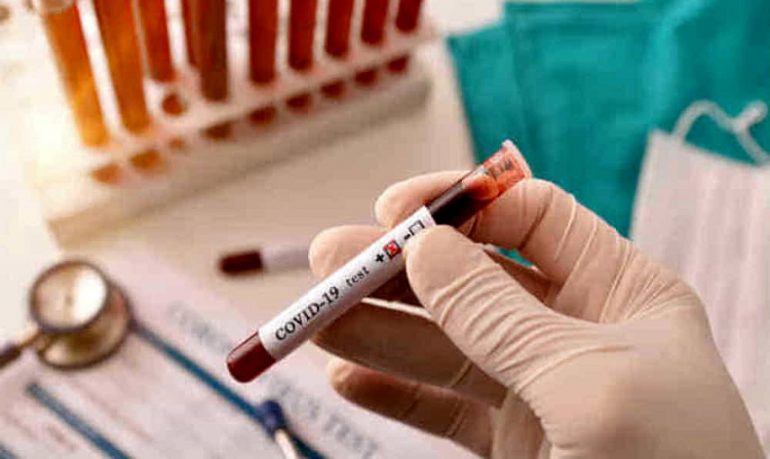 Coronavirus, anticorpi restano 6 mesi nel sangue dei guariti