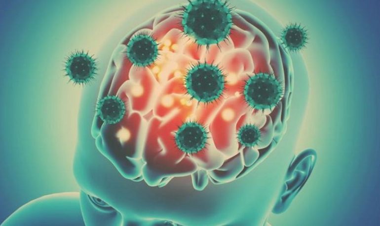 Coronavirus: le conseguenze neurologiche