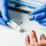 Test sierologico per coronavirus: anticorpi IgM e IgG