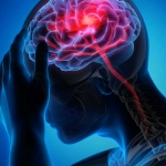 Il ruolo dell’infermiere nel monitoraggio della pressione intracranica (PIC)