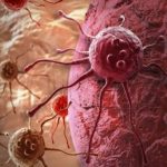 Tumori e infiammazione, scoperta una via da cui passano i "guardiani corrotti" del sistema immunitario