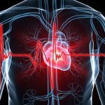 Aritmie ventricolari: un nuovo approccio chirurgico mininvasivo