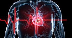 Aritmie ventricolari: un nuovo approccio chirurgico mininvasivo