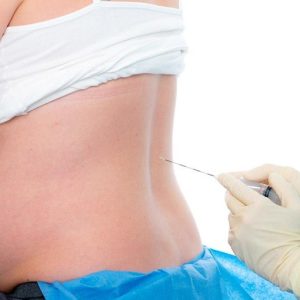 Autismo, studio canadese: "Nessuna associazione con analgesia epidurale"
