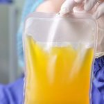 Coronavirus, studio Tsunami (Iss-Aifa): "Plasma dei guariti non riduce rischi"