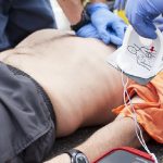 Defibrillatori, che fine ha fatto la legge sull'uso in ambiente extraospedaliero?