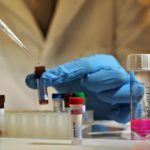 Hiv, studio Iss: risposta immune a proteina Tat determina recupero di linfociti CD4+ e controlla viremia residua nei pazienti in terapia cronica