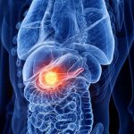 Verona, l'Istituto del pancreas celebra i 3mila interventi eseguiti in 20 anni