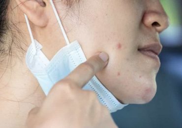 Coronavirus e problemi alla pelle: i consigli della SIDeMaST per scongiurare l'effetto "Covid face"