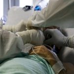 Coronavirus e stenosi tracheale: l'approccio al paziente