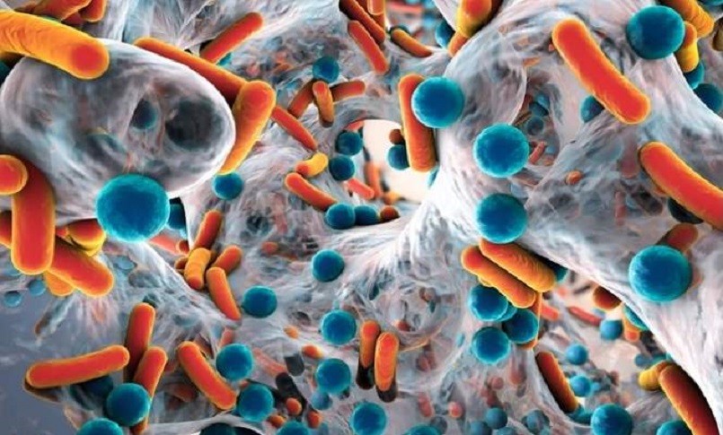 Il ruolo del microbioma intestinale nel recupero dall'ictus