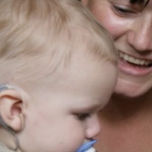 Orecchio bionico impiantato a bimbo di 10 mesi reso sordo dalla meningite: ora potrà sentire la voce della mamma 1