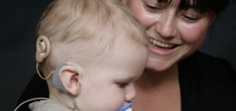 Orecchio bionico impiantato a bimbo di 10 mesi reso sordo dalla meningite: ora potrà sentire la voce della mamma 1