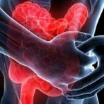 Malattia di Crohn e Colite Ulcerosa, pronta una nuova somministrazione sottocutanea. Terapie più semplici per i pazienti e meno pressione sugli ospedali