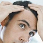 Calvizie, nasce a Roma il Centro Integrato Alopecie (Cia)