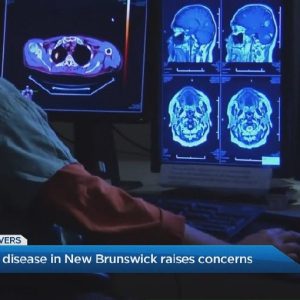 Canada, è allarme per una misteriosa sindrome neurologica