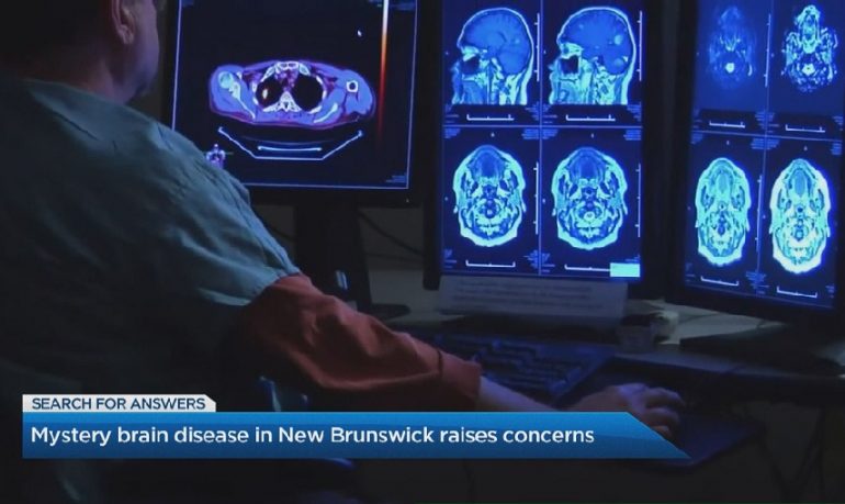 Canada, è allarme per una misteriosa sindrome neurologica