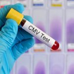 Citomegalovirus "mascherato" dai linfociti T killer: nuove prospettive di cura in vista