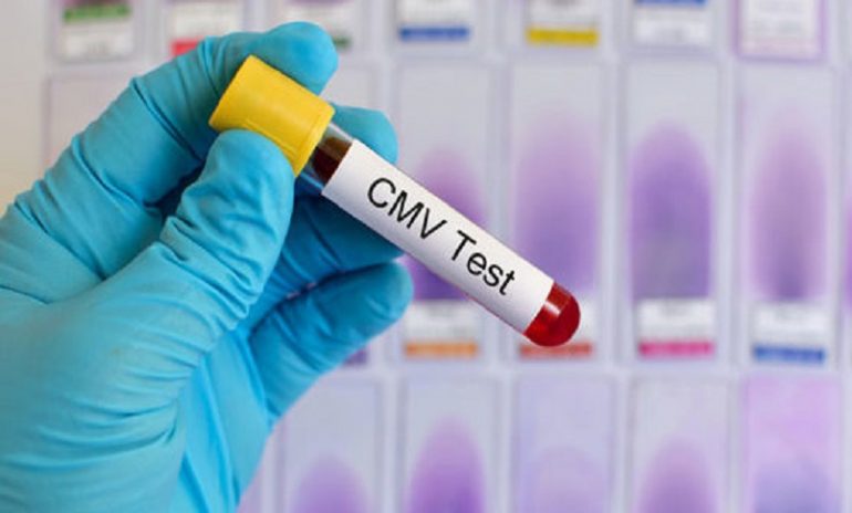 Citomegalovirus "mascherato" dai linfociti T killer: nuove prospettive di cura in vista