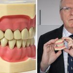DentalSlim Diet Control: il primo device in grado di serrare mandibola e mascella per combattere l’obesità