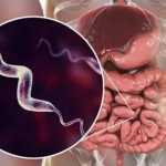 Infezione da Campylobacter: possibile la trasmissione per via sessuale
