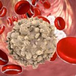 Leucemia linfatica cronica, nuovo farmaco promette miglior controllo della malattia