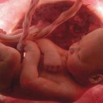 Placenta, cordone ombelicale e sacco amniotico: a cosa servono?