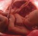 Placenta, cordone ombelicale e sacco amniotico: a cosa servono?