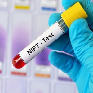 Test Dna fetale gratuito per donne over 40 o a rischio: Puglia fa da apripista