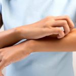 Allergie: a cosa bisogna fare attenzione in estate?