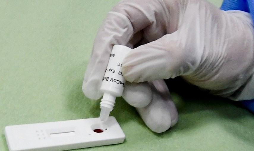 Coronavirus, sviluppato in Svizzera un nuovo test per misurare l'efficacia della protezione contro le varianti