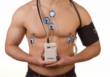 ECG (elettrocardiogramma) dinamico secondo Holter: a cosa serve?