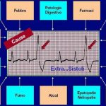Extrasistole: è controindicato fare sport?