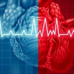 Fibrillazione atriale: i vantaggi della Meditereanea Technique