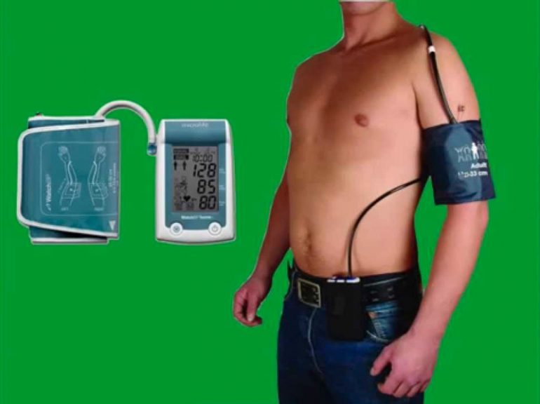 Holter Pressorio: cos’è? Quando si prescrive? Come si svolge?