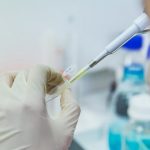 Malattie genetiche rare parossistiche, scoperto il ruolo di una mutazione genetica