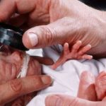 Retinopatia dei nati pretermine: nuove possibilità diagnostiche e un farmaco salva-vista