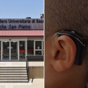 Sassari, "orecchio bionico" impiantato su bimbo di 7 anni