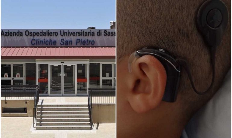 Sassari, "orecchio bionico" impiantato su bimbo di 7 anni