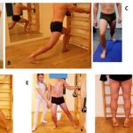 Trattamento riabilitativo post-operatorio delle fratture pertrocanteriche del femore 3