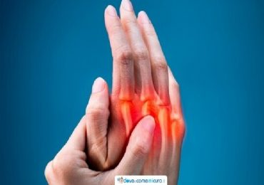 Artrite reumatoide: batterio delle gengive possibile agente scatenante