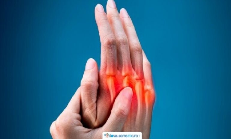 Artrite reumatoide: batterio delle gengive possibile agente scatenante