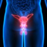 Noduli al testicolo: sintomo di possibile tumore?