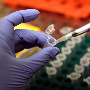 Stress, Simcri: "Occhio al ruolo delle cellule staminali"