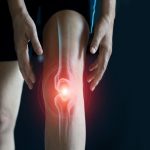 Usura della cartilagine del ginocchio: una piossibile soluzione dai condrociti nasali